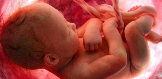 Субсерозная миома матки и беременность