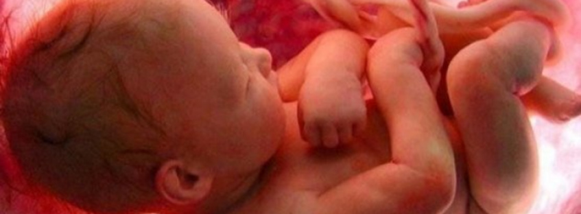 Субсерозная миома матки и беременность